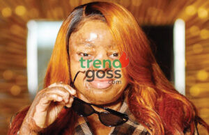 Kechi Okwuchi Undergoes Eyelid Surgery: A Survivor’s Journey Continues